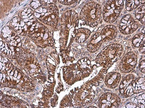 TOMM40 Antibody in Immunohistochemistry (Paraffin) (IHC (P))