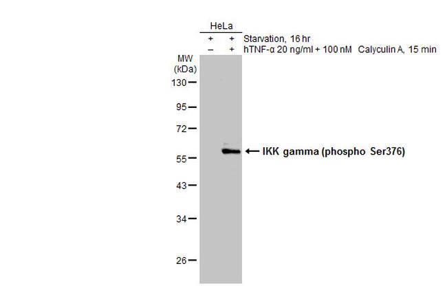 Phospho-IKK gamma (Ser376) Antibody in Western Blot (WB)