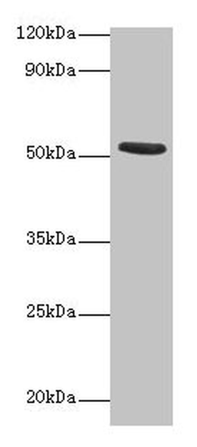 Torpedo californica CHRNA1 Antibody in Western Blot (WB)