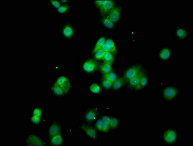 CYP8B1 Antibody in Immunocytochemistry (ICC/IF)