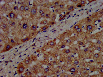 CYP8B1 Antibody in Immunohistochemistry (Paraffin) (IHC (P))