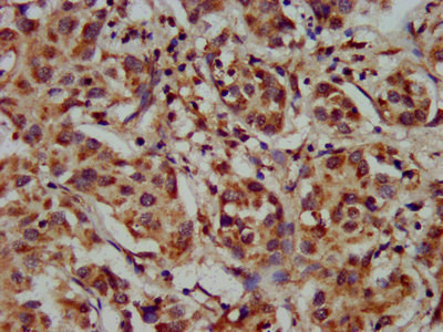 CYP8B1 Antibody in Immunohistochemistry (Paraffin) (IHC (P))