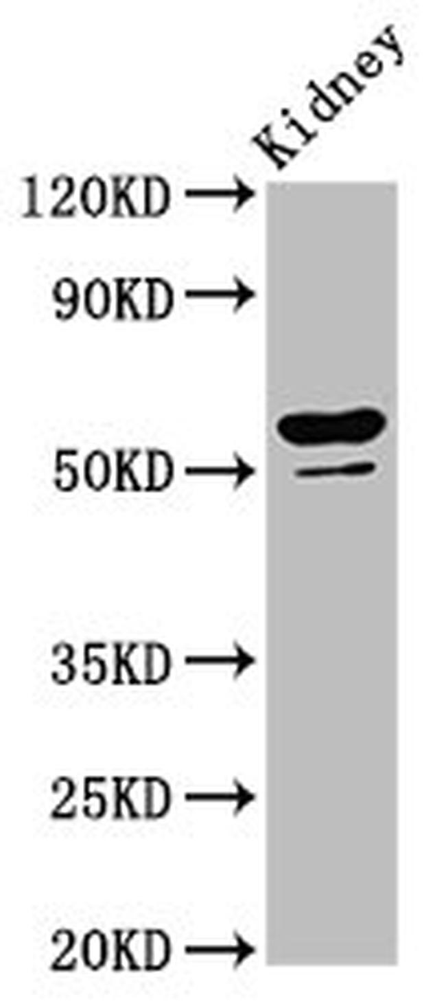 CYP8B1 Antibody in Western Blot (WB)