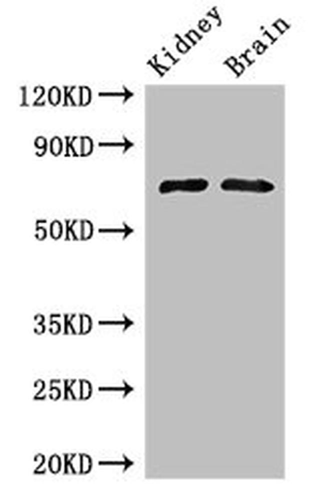 GAA Antibody in Western Blot (WB)