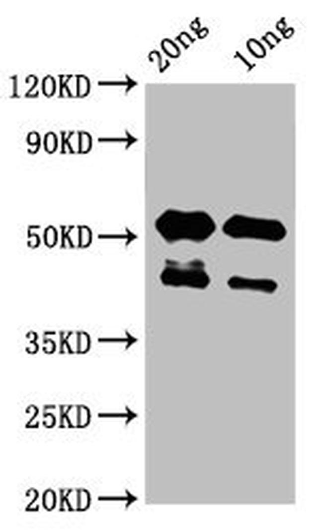 LATS2 Antibody in Western Blot (WB)