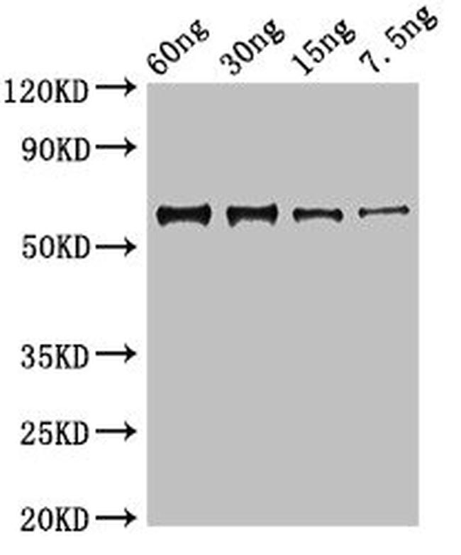 Junin mammarenavirus Nucleoprotein Antibody in Western Blot (WB)