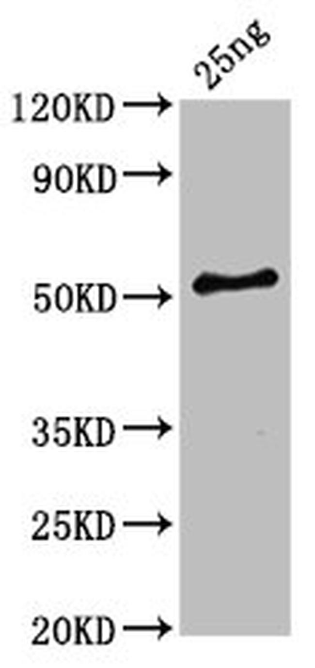 Clostridium botulinum HA-33 Antibody in Western Blot (WB)