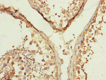 MFN1 Antibody in Immunohistochemistry (Paraffin) (IHC (P))