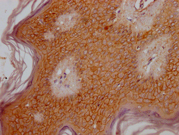 OR6B3 Antibody in Immunohistochemistry (Paraffin) (IHC (P))