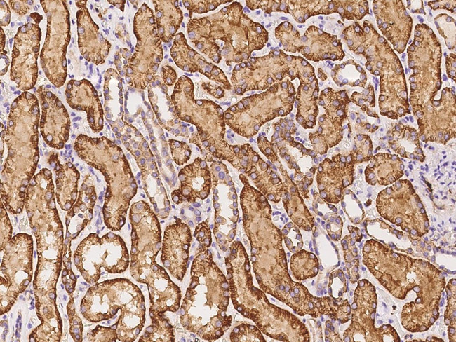 alpha Adducin Antibody in Immunohistochemistry (Paraffin) (IHC (P))