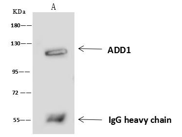 alpha Adducin Antibody in Immunoprecipitation (IP)