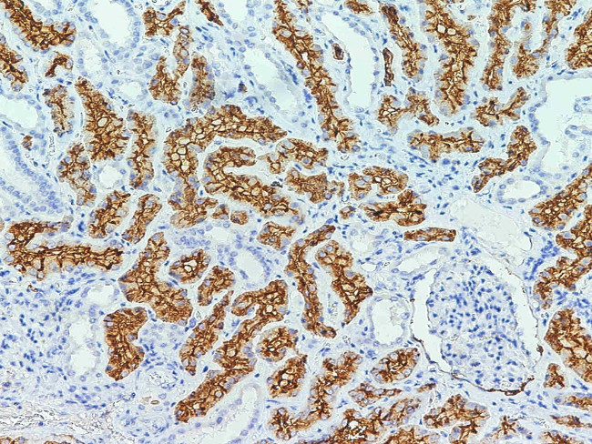 CD13 Antibody in Immunohistochemistry (Paraffin) (IHC (P))