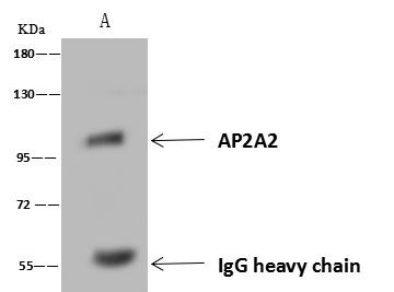 AP2A2 Antibody in Immunoprecipitation (IP)