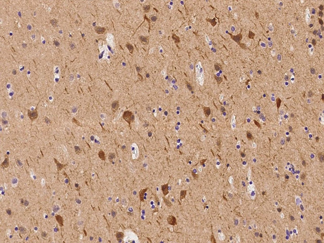 Apolipoprotein L2 Antibody in Immunohistochemistry (Paraffin) (IHC (P))