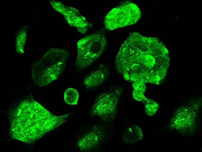 CBF beta Antibody in Immunocytochemistry (ICC/IF)