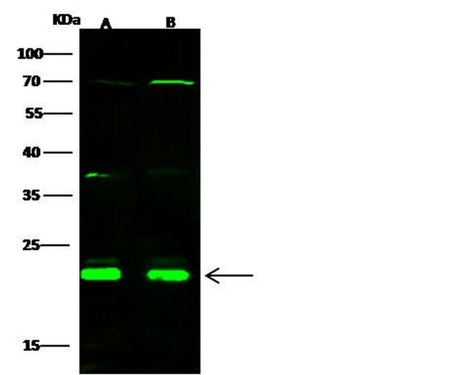 CBF beta Antibody in Western Blot (WB)