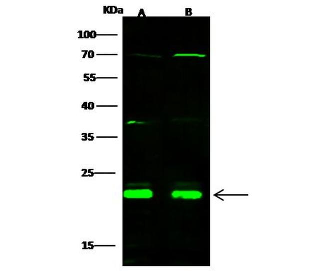 CBF beta Antibody in Western Blot (WB)