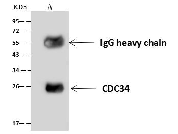 Cdc34 Antibody in Immunoprecipitation (IP)
