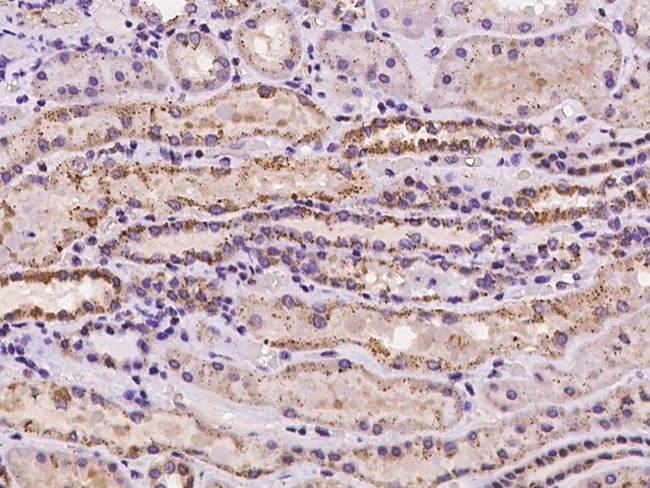 CHMP4A Antibody in Immunohistochemistry (Paraffin) (IHC (P))