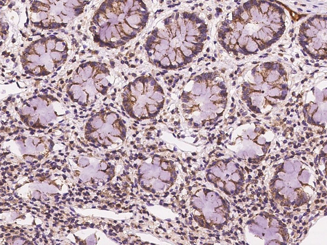 CHMP4A Antibody in Immunohistochemistry (Paraffin) (IHC (P))