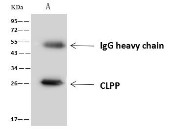 CLPP Antibody in Immunoprecipitation (IP)