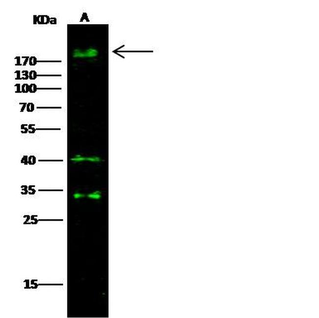 ErbB3 Antibody in Western Blot (WB)