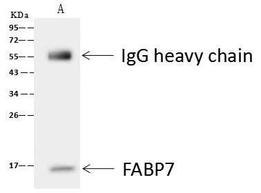 FABP7 Antibody in Immunoprecipitation (IP)