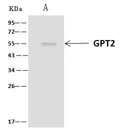 GPT2 Antibody in Immunoprecipitation (IP)