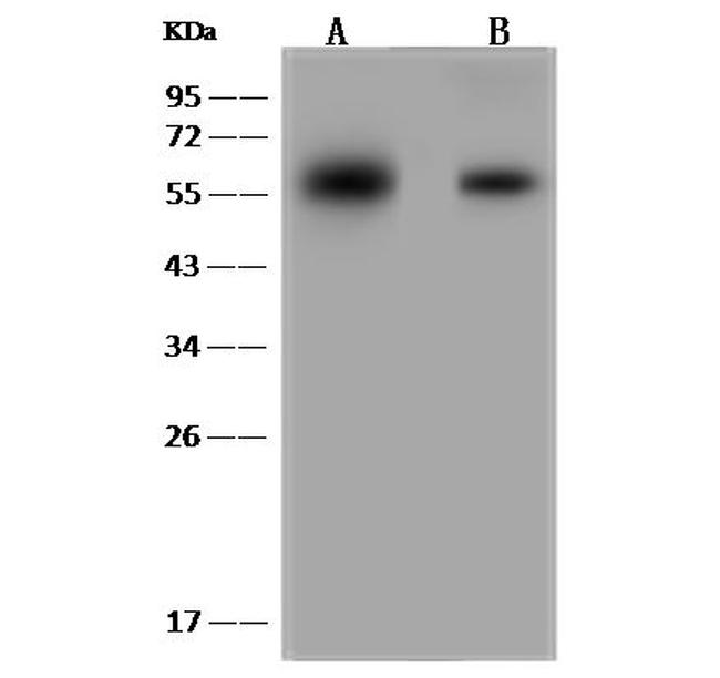 GPT2 Antibody in Western Blot (WB)