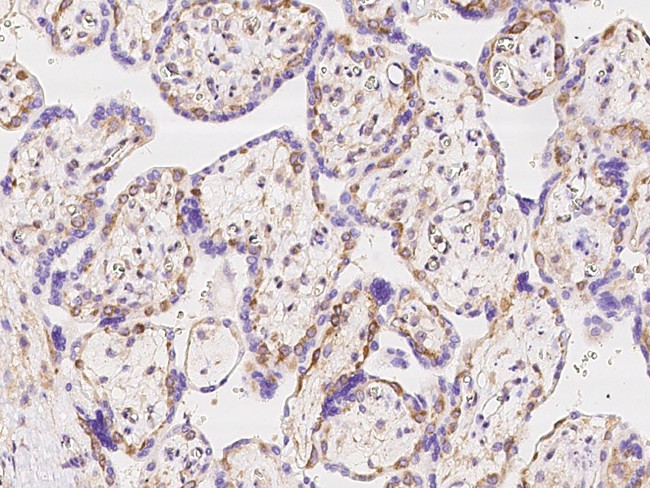 IMPDH2 Antibody in Immunohistochemistry (Paraffin) (IHC (P))