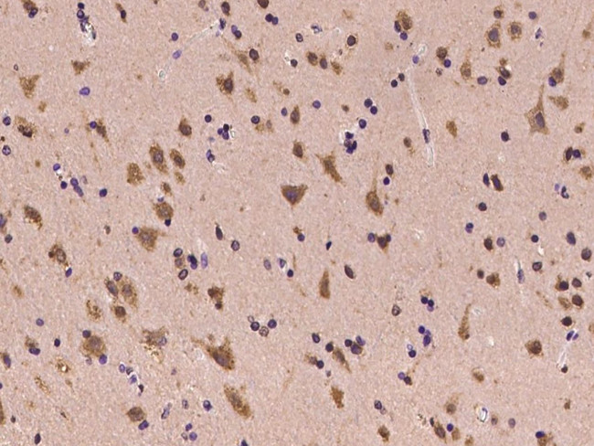 LIAS Antibody in Immunohistochemistry (Paraffin) (IHC (P))