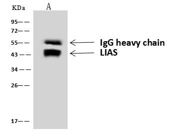 LIAS Antibody in Immunoprecipitation (IP)