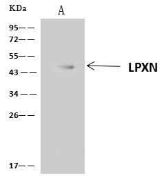 LPXN Antibody in Immunoprecipitation (IP)