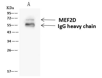 MEF2D Antibody in Immunoprecipitation (IP)