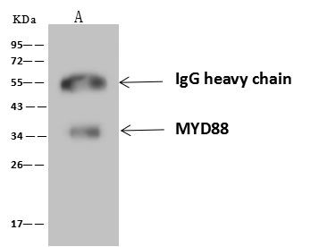 MyD88 Antibody in Immunoprecipitation (IP)