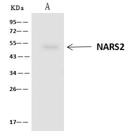 NARS2 Antibody in Immunoprecipitation (IP)