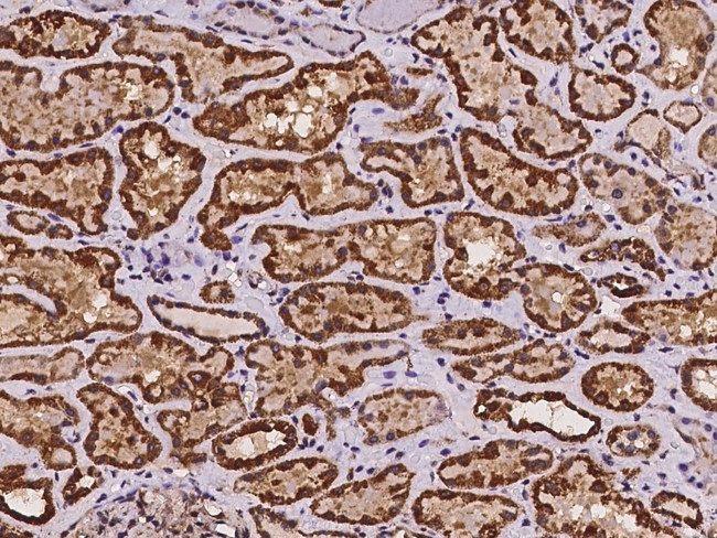 NDUFS6 Antibody in Immunohistochemistry (Paraffin) (IHC (P))