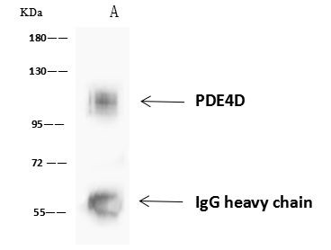 PDE4D Antibody in Immunoprecipitation (IP)