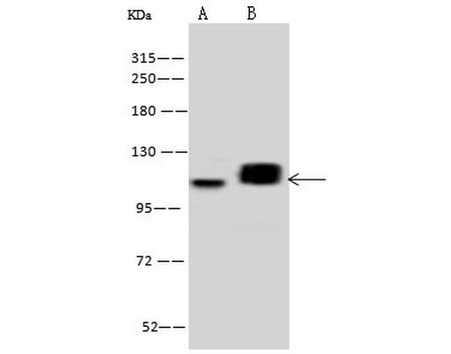 PDE4D Antibody in Western Blot (WB)