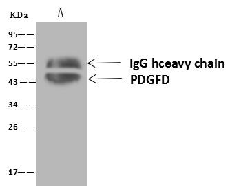 PDGF-D Antibody in Immunoprecipitation (IP)