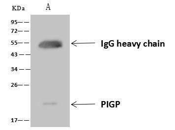 PIGP Antibody in Immunoprecipitation (IP)