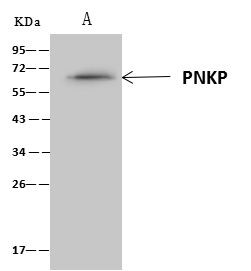 PNK Antibody in Immunoprecipitation (IP)