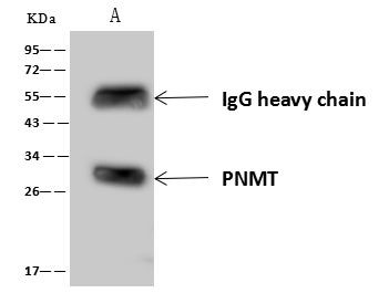 PNMT Antibody in Immunoprecipitation (IP)