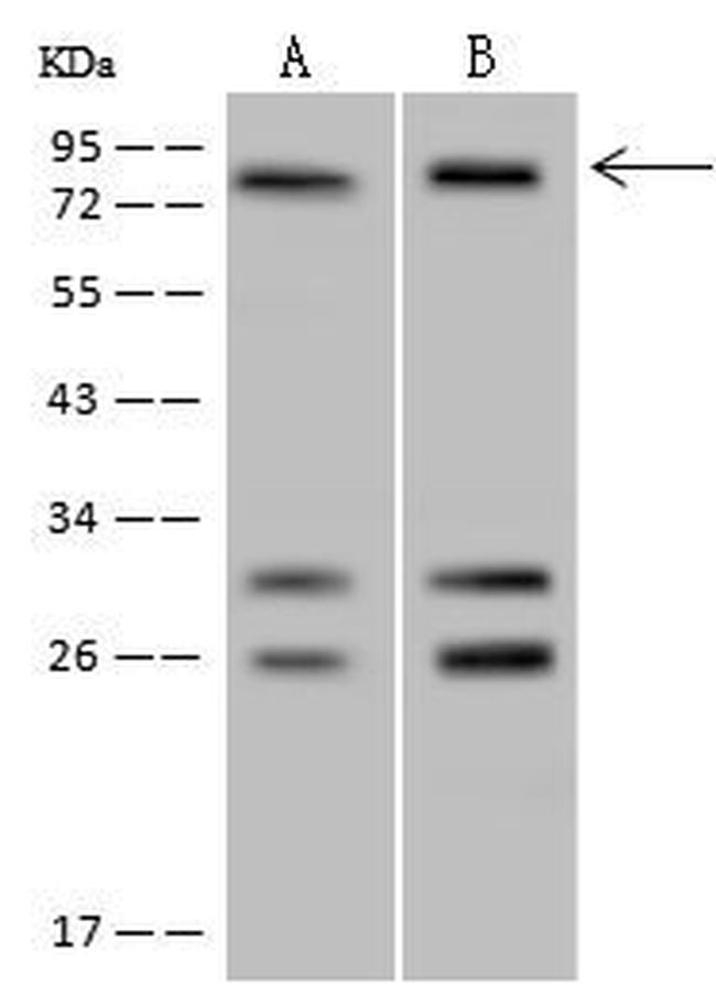 POLR3E Antibody in Western Blot (WB)