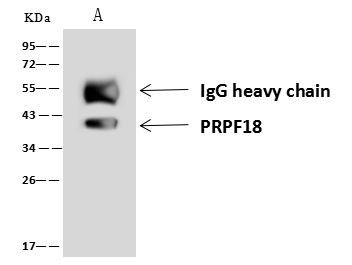 PRPF18 Antibody in Immunoprecipitation (IP)