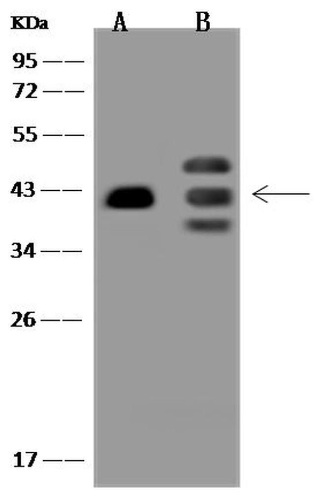 PRPF18 Antibody in Western Blot (WB)