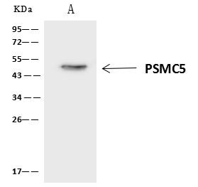 PSMC5 Antibody in Immunoprecipitation (IP)