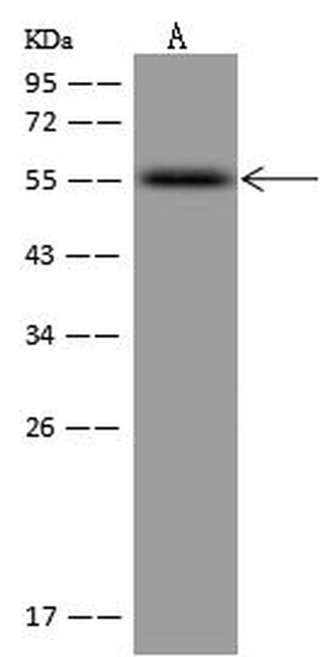 RXRB Antibody in Western Blot (WB)