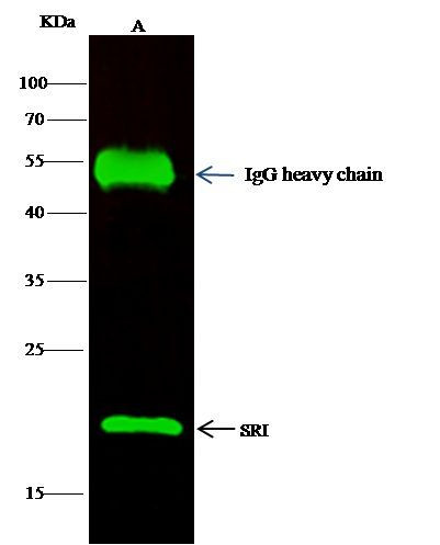 Sorcin Antibody in Immunoprecipitation (IP)