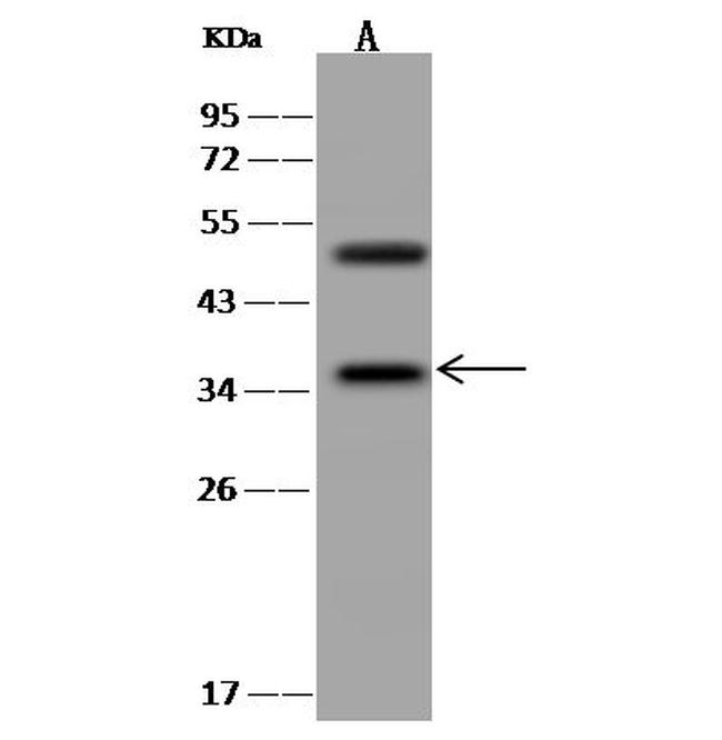STAP1 Antibody in Western Blot (WB)